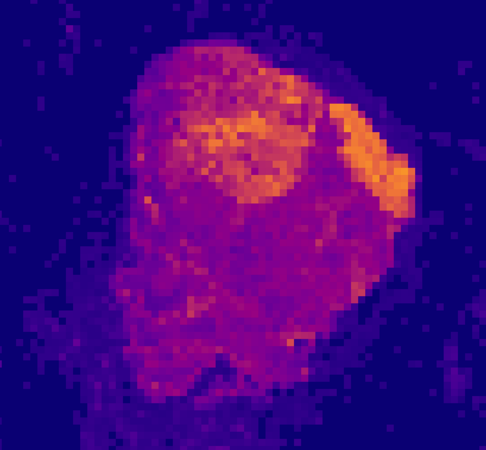 A heatmap of potentially cancerous tissue