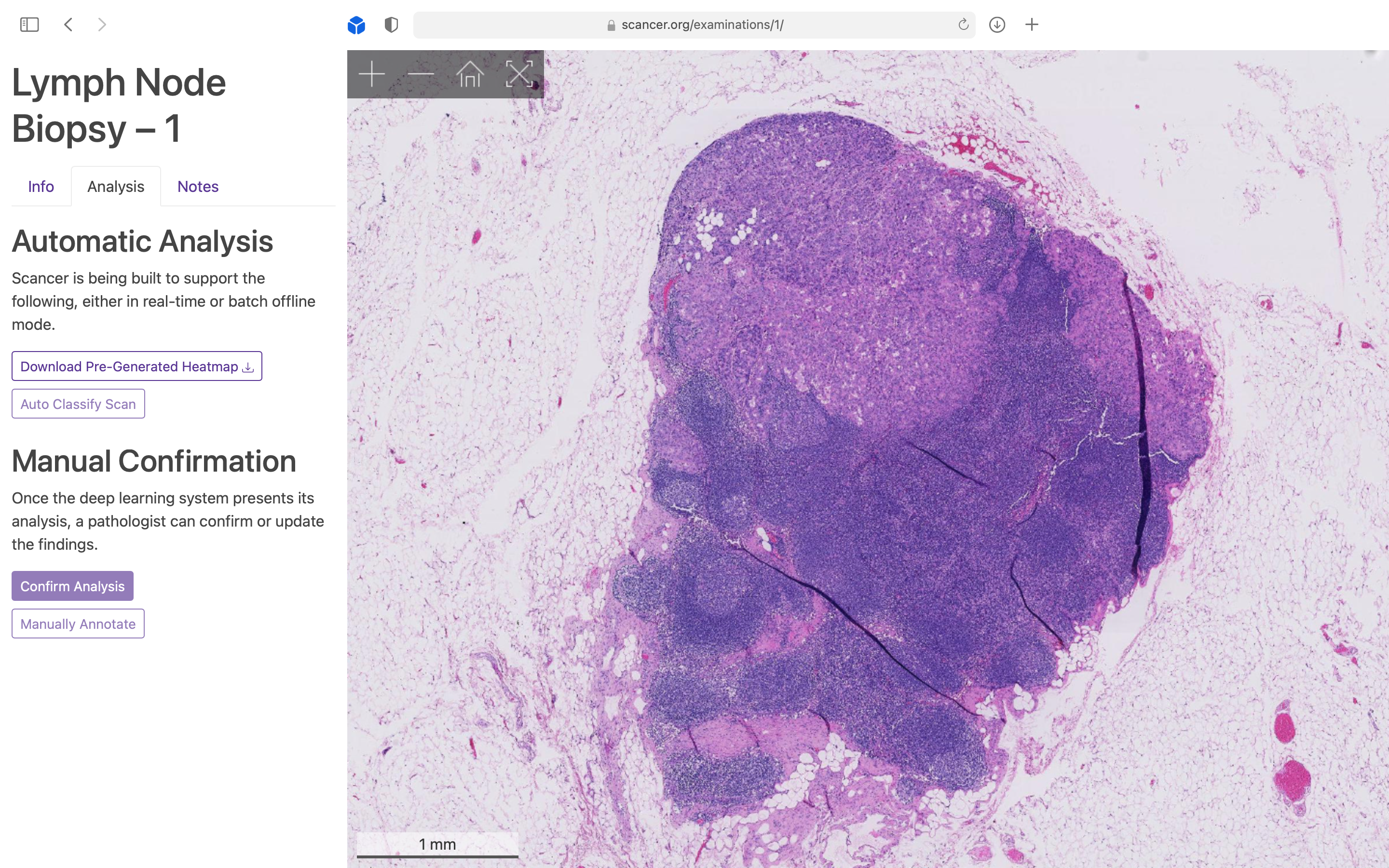 Visualisation of a Whole Slide Image (WSI) using a Google Maps style zoom interface